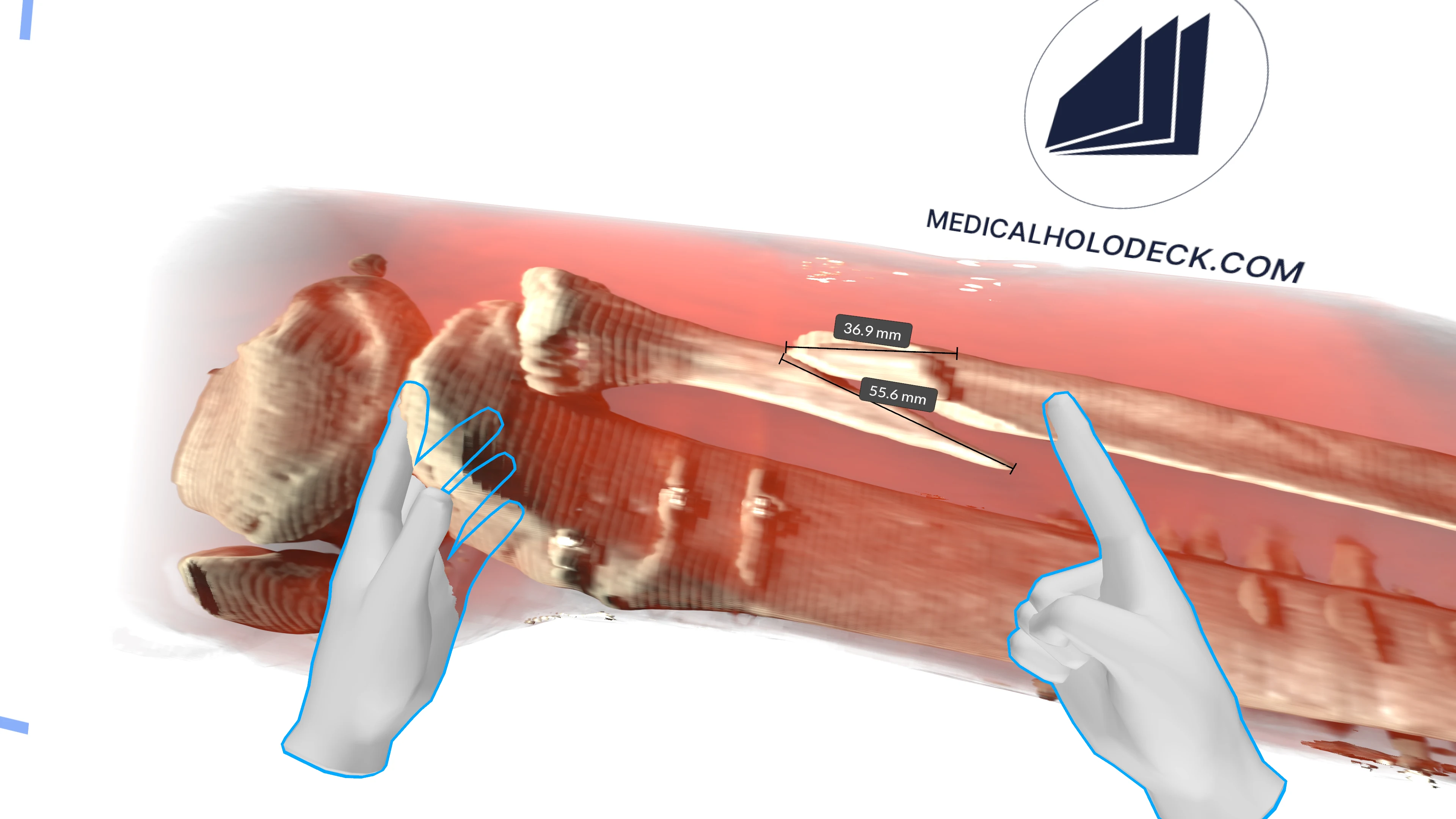 Medicalholodeck spatial imaging displayed across a large screen and companion devices.