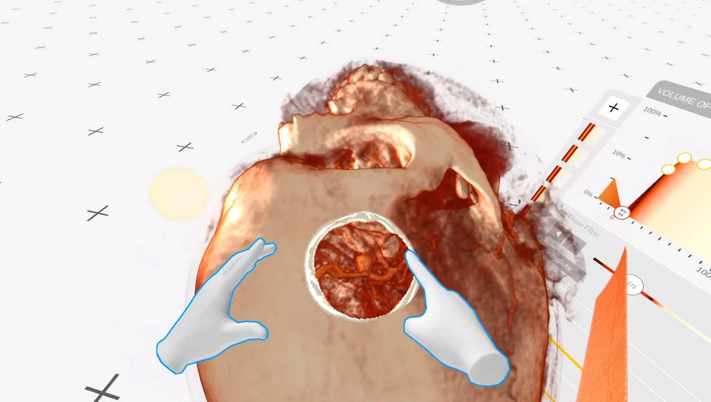 Virtual hands interacting with spatial medical imaging for training