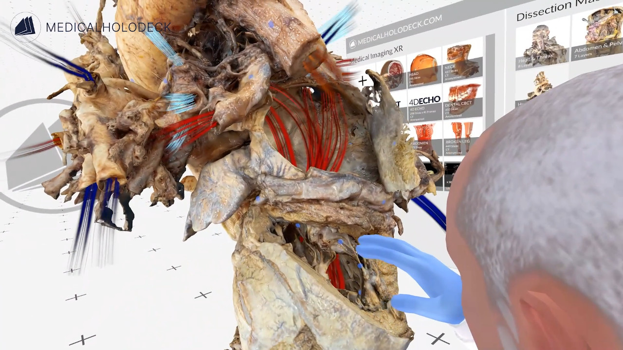 The blood flow through the heart thumbnail 3