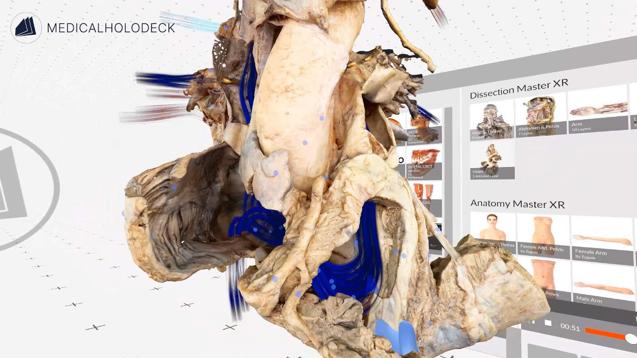 The blood flow through the heart thumbnail 2