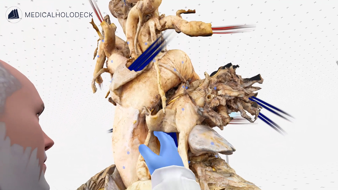 The blood flow through the heart thumbnail 4