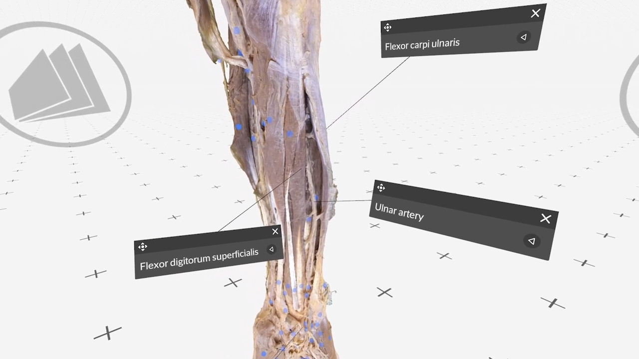 The ulnar artery thumbnail 2