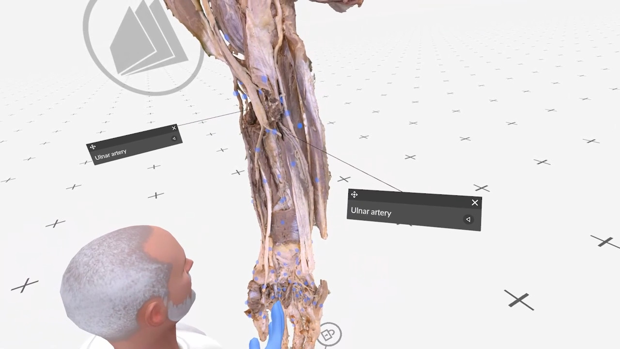 The ulnar artery thumbnail 5