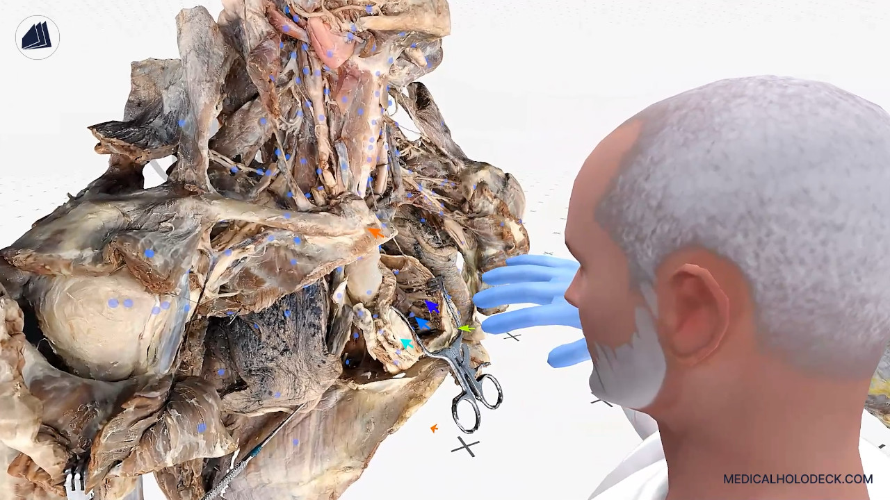 The head and thorax thumbnail 5