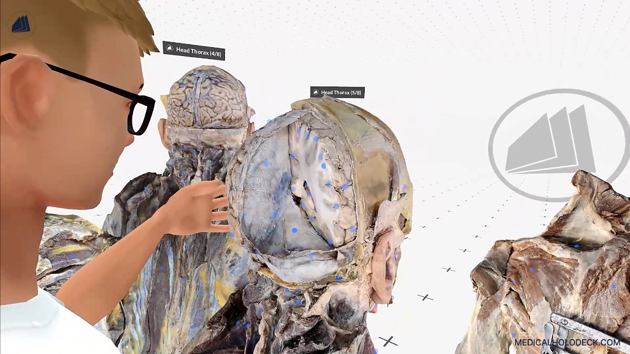 A journey through the human brain thumbnail 3