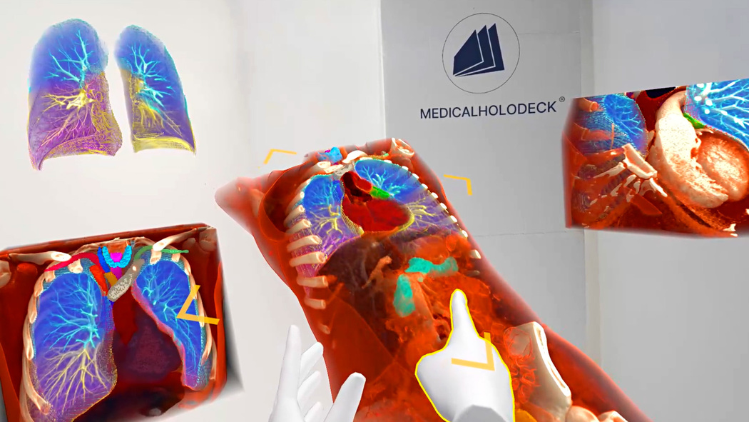 Latest advances in AI segmentation