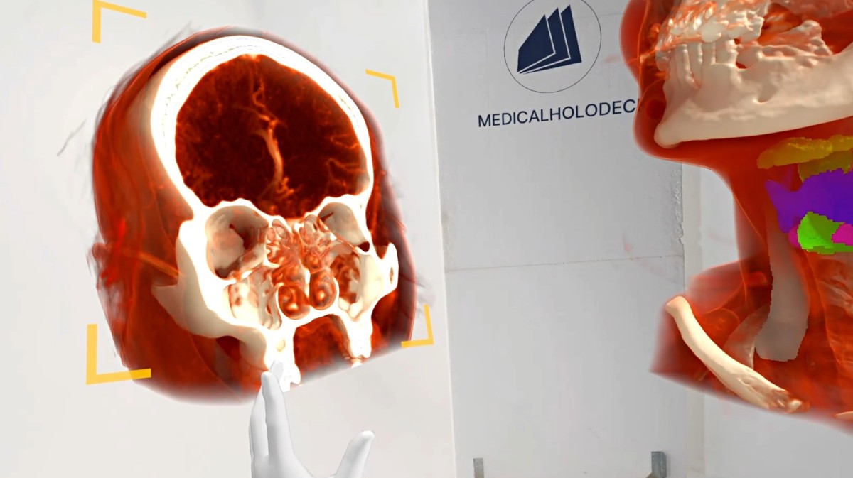 Maxillofacial surgery