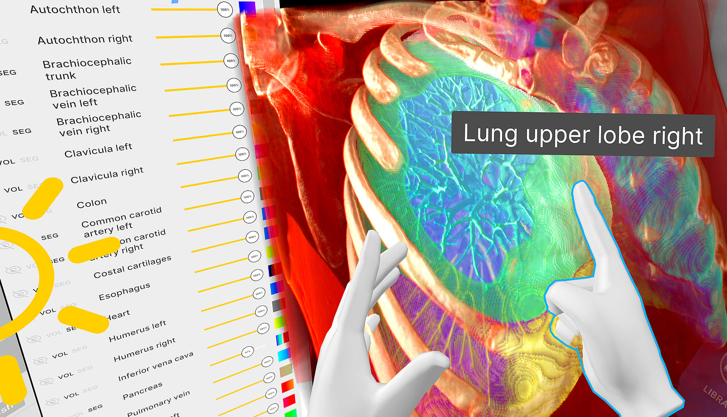 Medicalholodeck AI - Medical imaging and segmentation