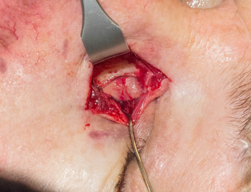 Article Header Image