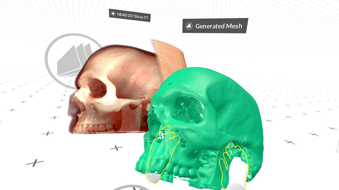 Export DICOM to STL for 3D printing