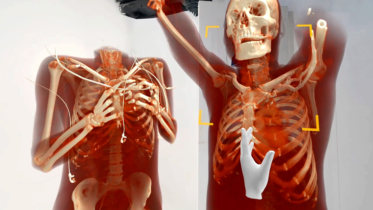 Digital twins in medical XR