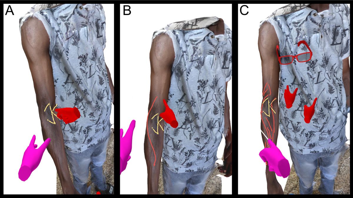 Virtual surgical case conference