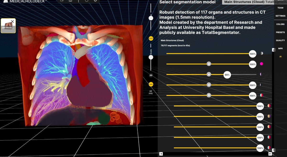 Glasses-free 3D screens: The next level of immersion