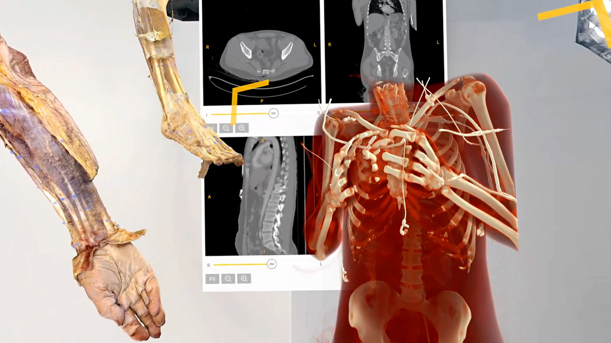 How extended reality is transforming orthopedics