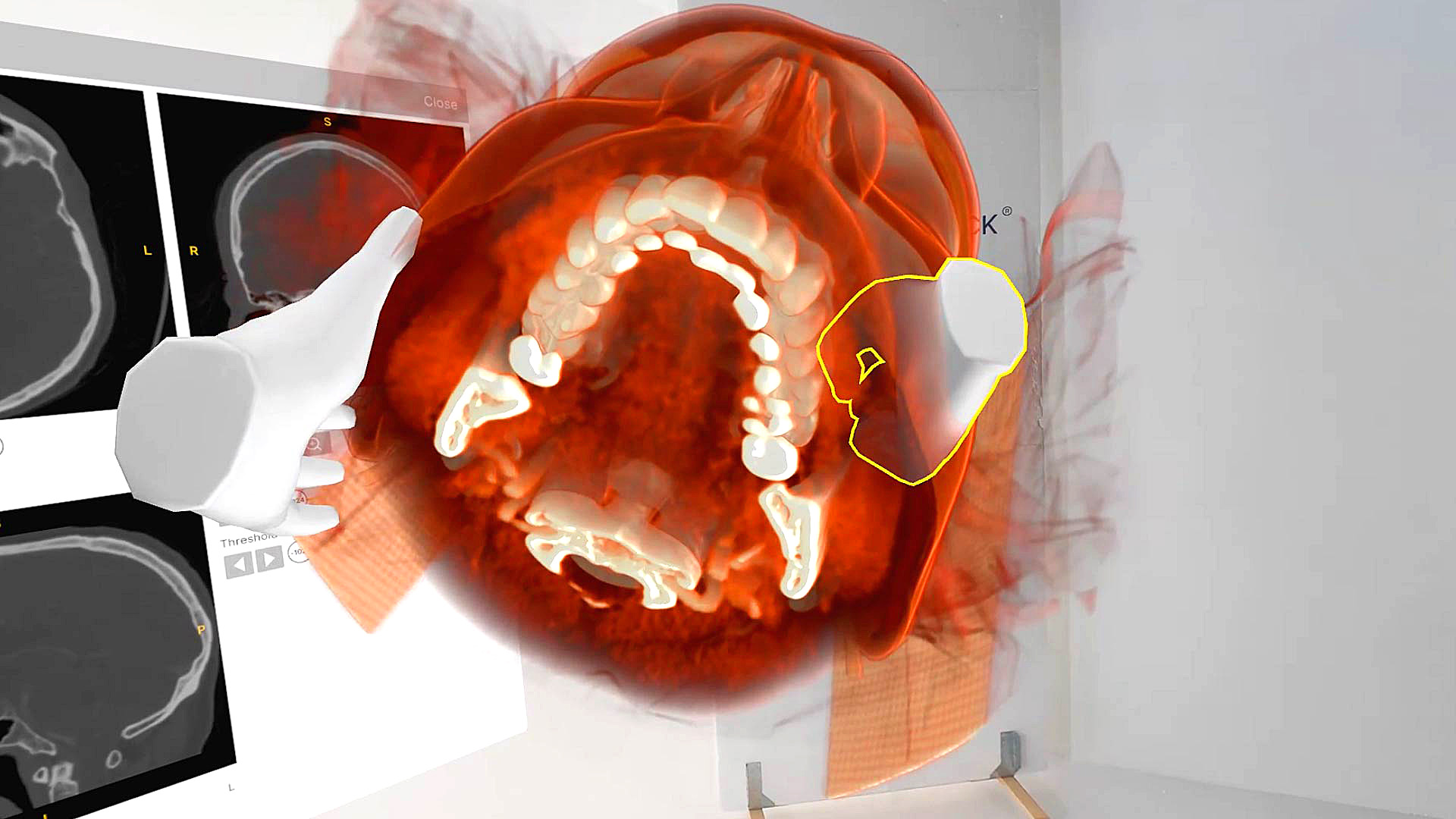 What’s new: July 2025 update (v1.6.0)