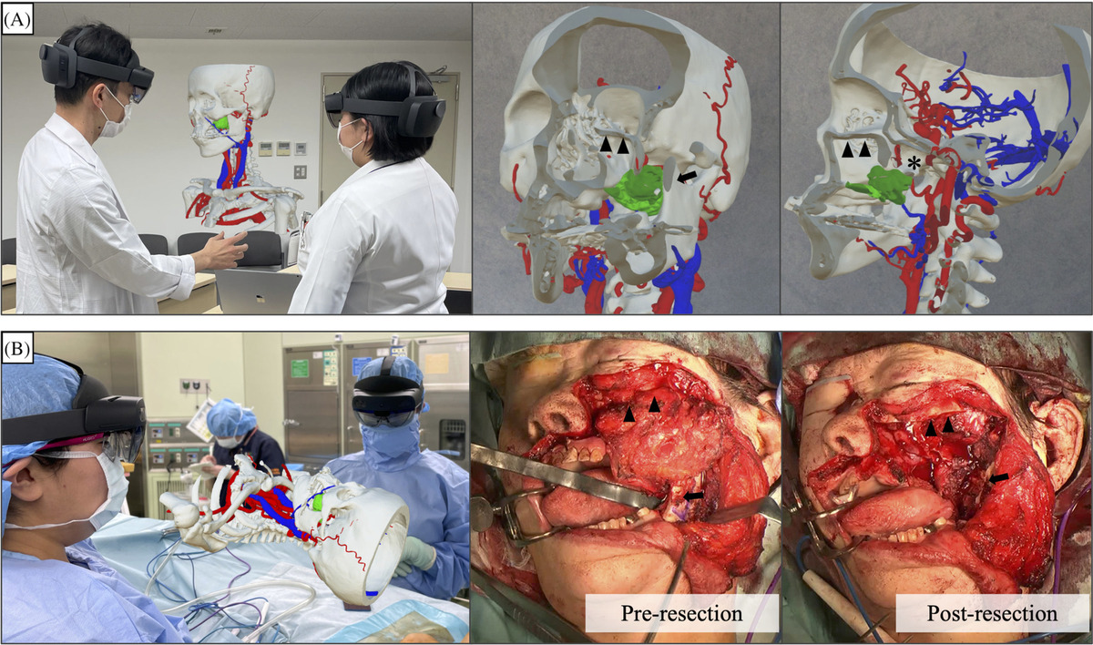 Otolaryngology surgery