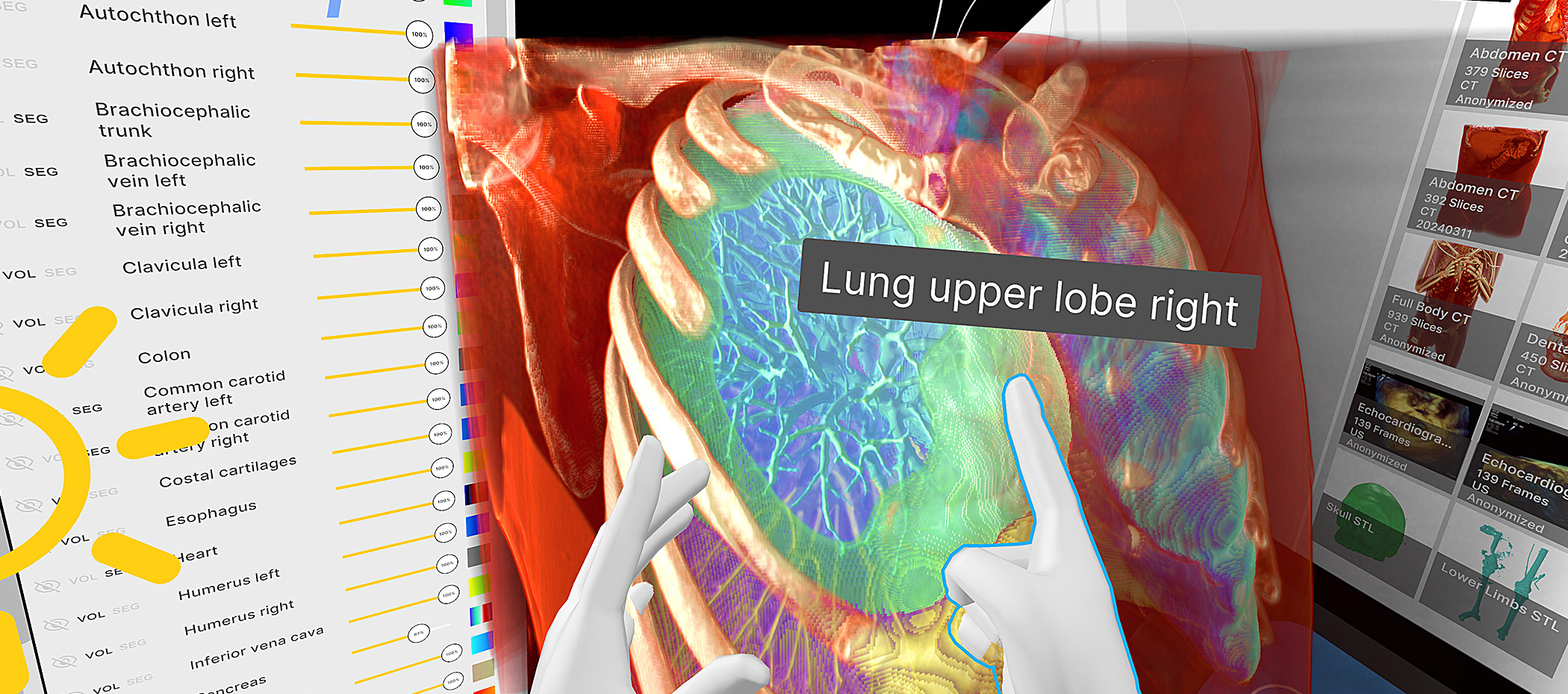 Advanced 3D: spatial visualization for case review, discussion, and training