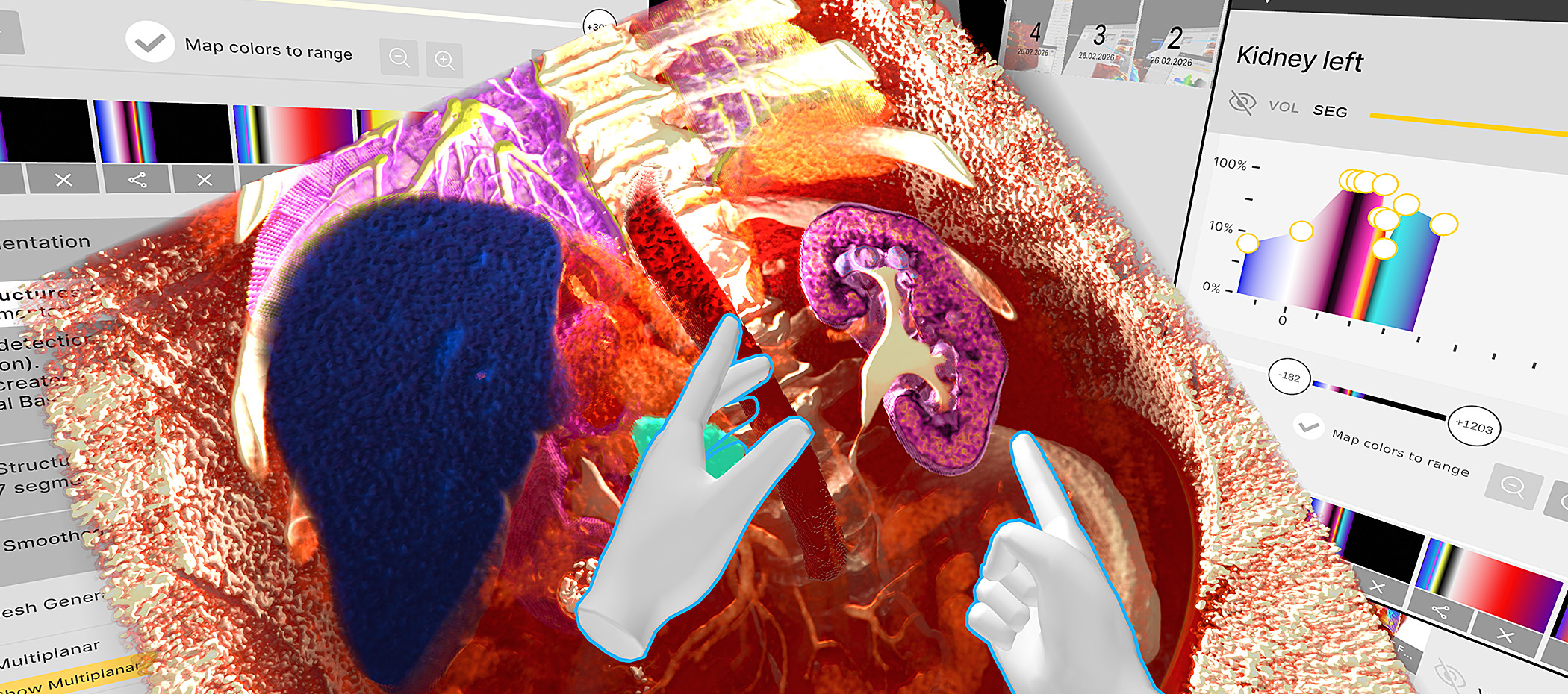 Fast, precise, secure: local segmentation, PACS, and HIPAA-compliant security