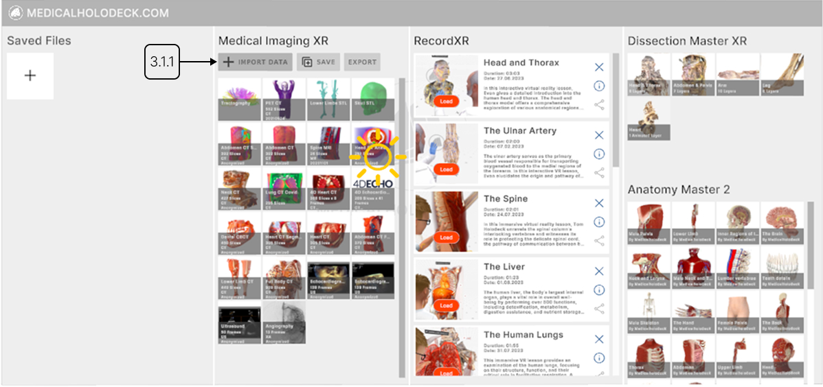 Running AI segmentation